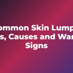 Common Skin Lumps: Types, Causes and Warning Signs